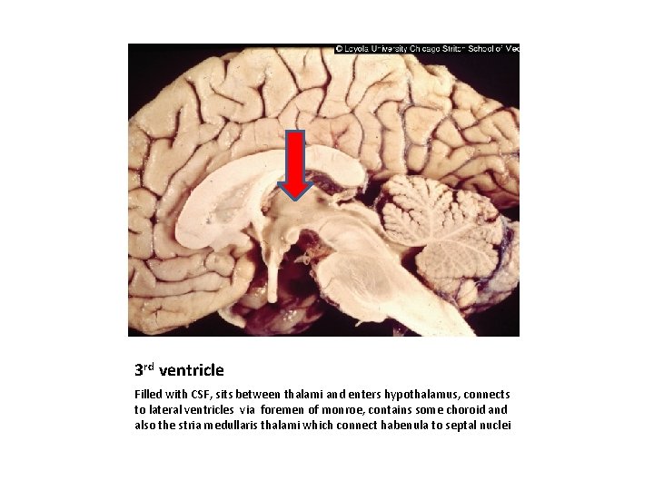 3 rd ventricle Filled with CSF, sits between thalami and enters hypothalamus, connects to