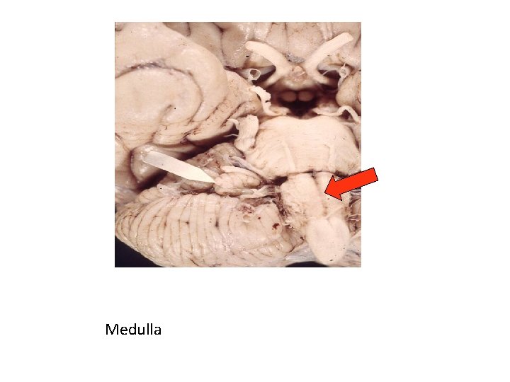 Medulla 