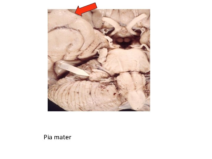 Pia mater 