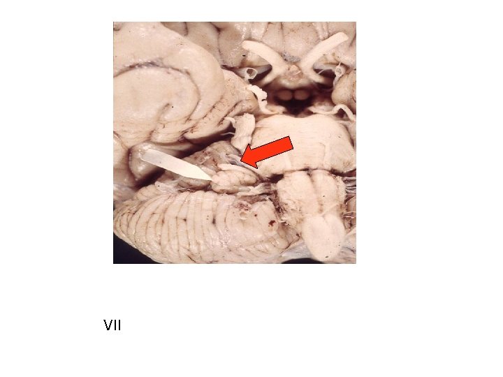 VII 