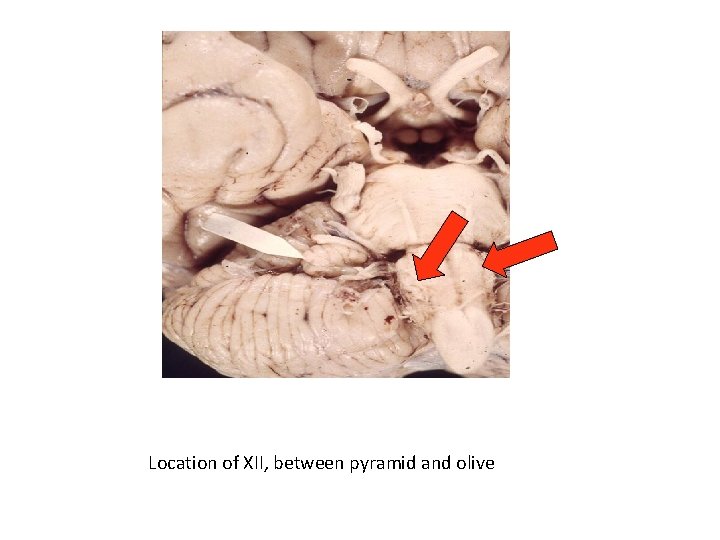 Location of XII, between pyramid and olive 