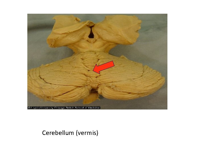 Cerebellum (vermis) 