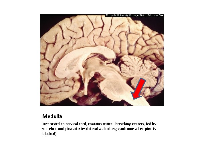 Medulla Just rostral to cervical cord, contains critical breathing centers, fed by vertebral and