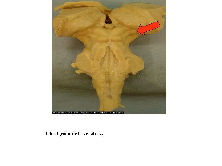 Lateral geniculate for visual relay 