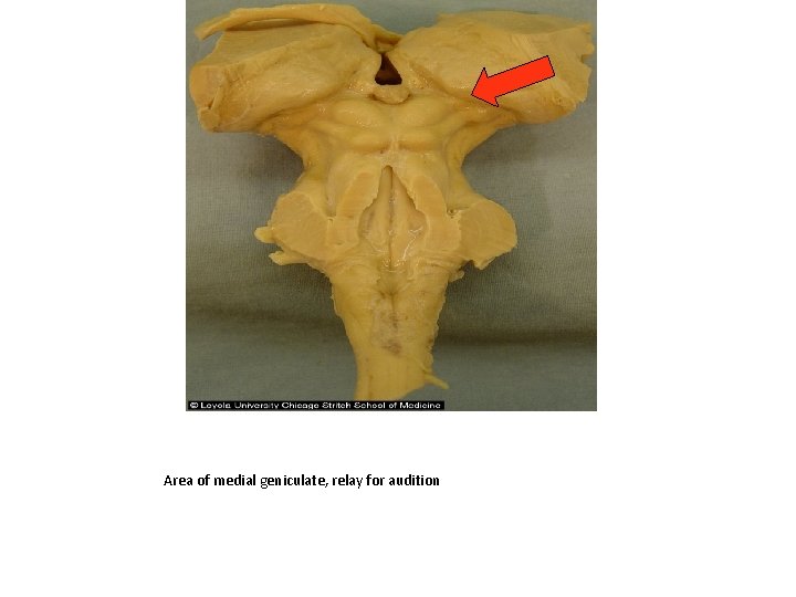 Area of medial geniculate, relay for audition 