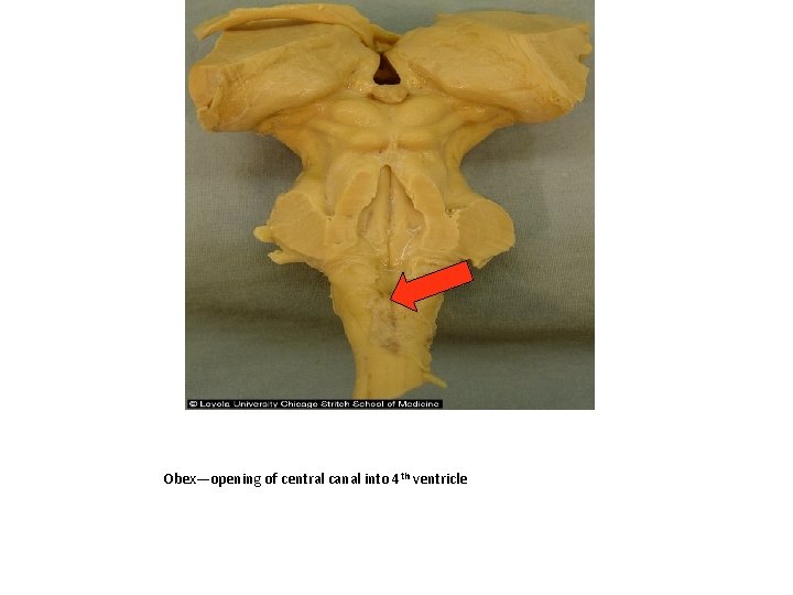 Obex—opening of central canal into 4 th ventricle 