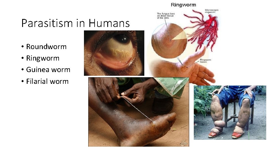 Parasitism in Humans • Roundworm • Ringworm • Guinea worm • Filarial worm 
