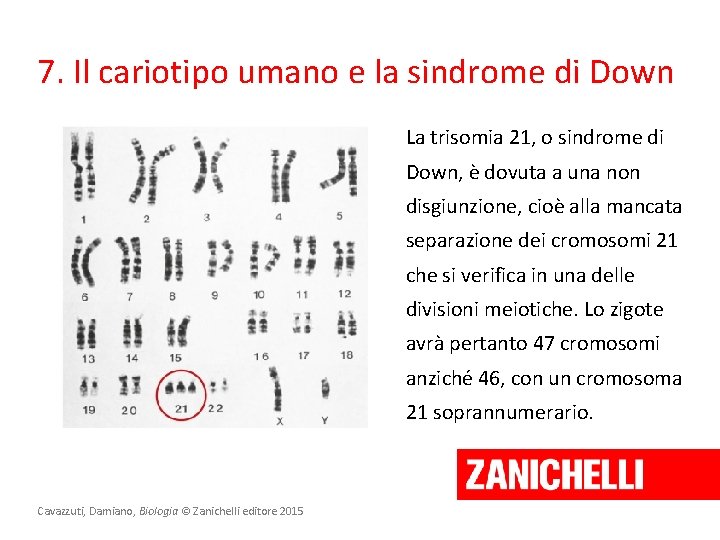 7. Il cariotipo umano e la sindrome di Down La trisomia 21, o sindrome