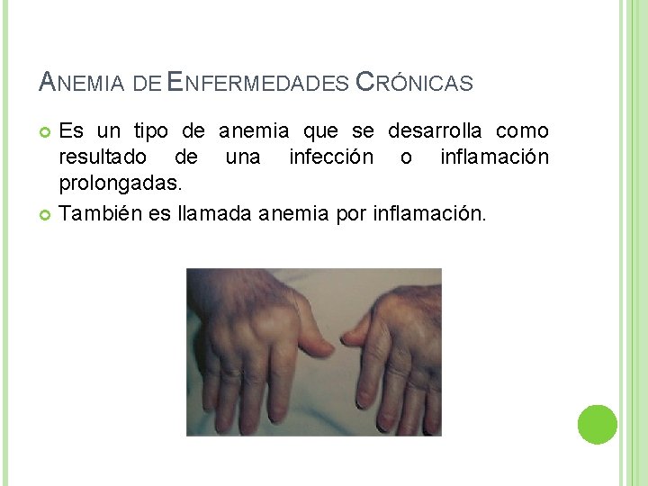 ANEMIA DE ENFERMEDADES CRÓNICAS Es un tipo de anemia que se desarrolla como resultado