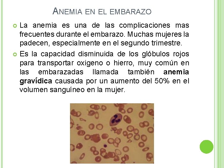 ANEMIA EN EL EMBARAZO La anemia es una de las complicaciones mas frecuentes durante