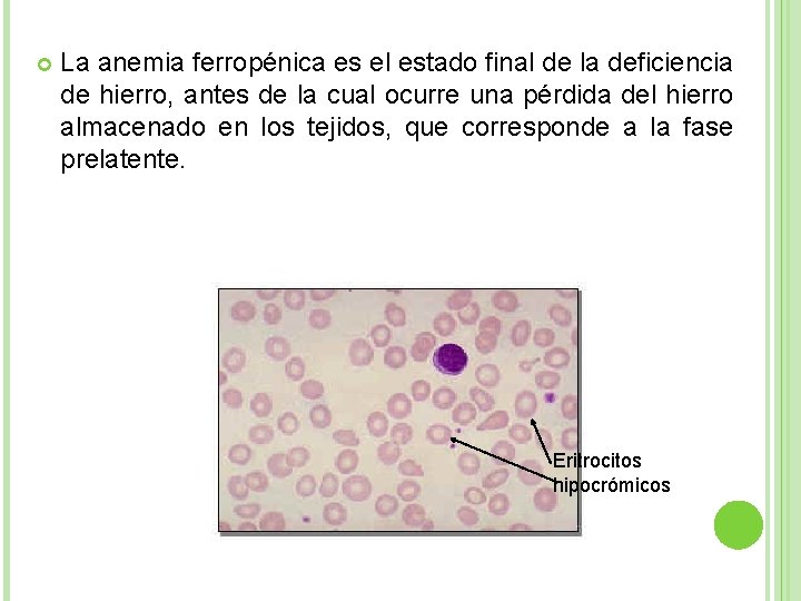  La anemia ferropénica es el estado final de la deficiencia de hierro, antes