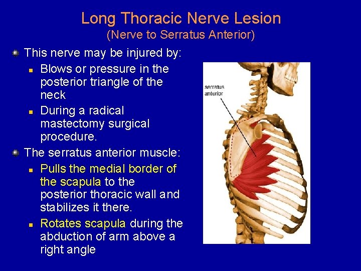 Long Thoracic Nerve Lesion (Nerve to Serratus Anterior) This nerve may be injured by: