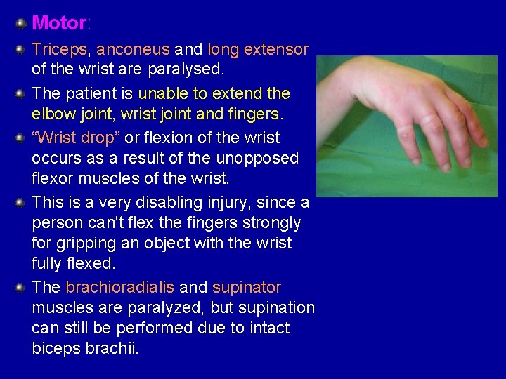 Motor: Triceps, anconeus and long extensor of the wrist are paralysed. The patient is