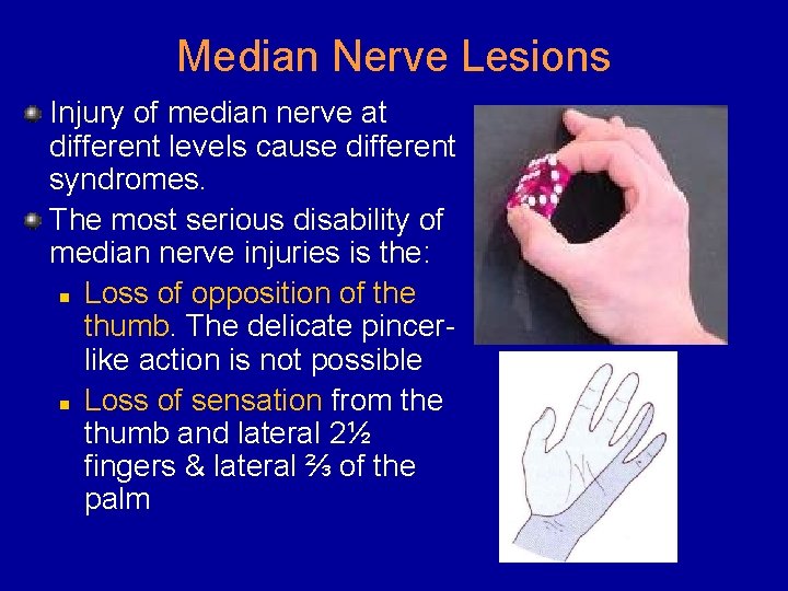 Median Nerve Lesions Injury of median nerve at different levels cause different syndromes. The
