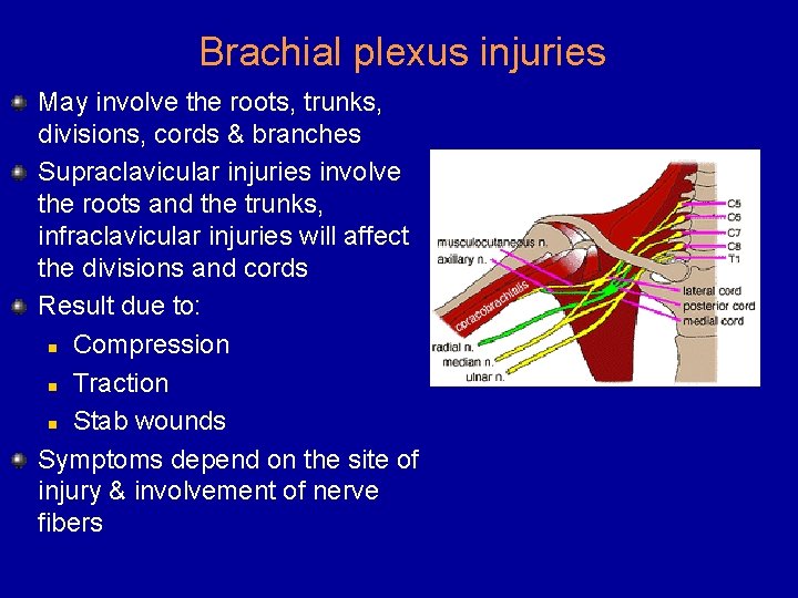 Brachial plexus injuries May involve the roots, trunks, divisions, cords & branches Supraclavicular injuries