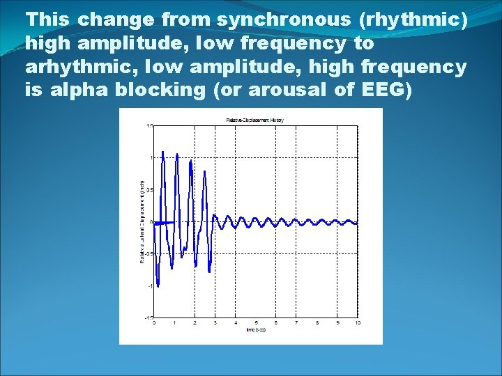 This change from synchronous (rhythmic) high amplitude, low frequency to arhythmic, low amplitude, high