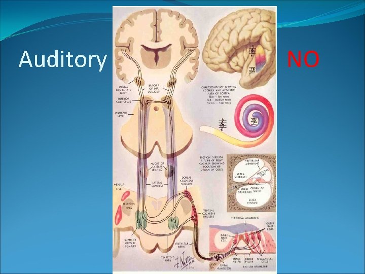 Auditory pathways NO 