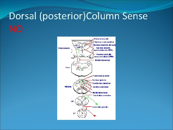 Dorsal (posterior)Column Sense NO 