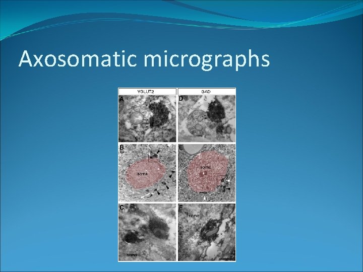 Axosomatic micrographs 