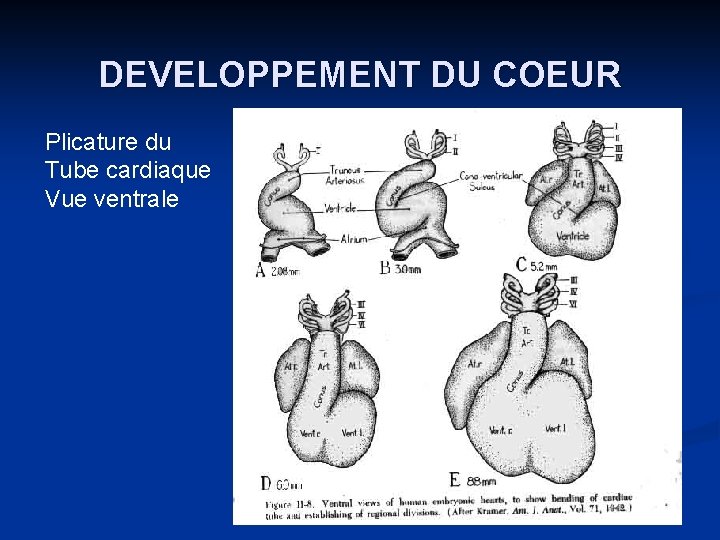 DEVELOPPEMENT DU COEUR Plicature du Tube cardiaque Vue ventrale 