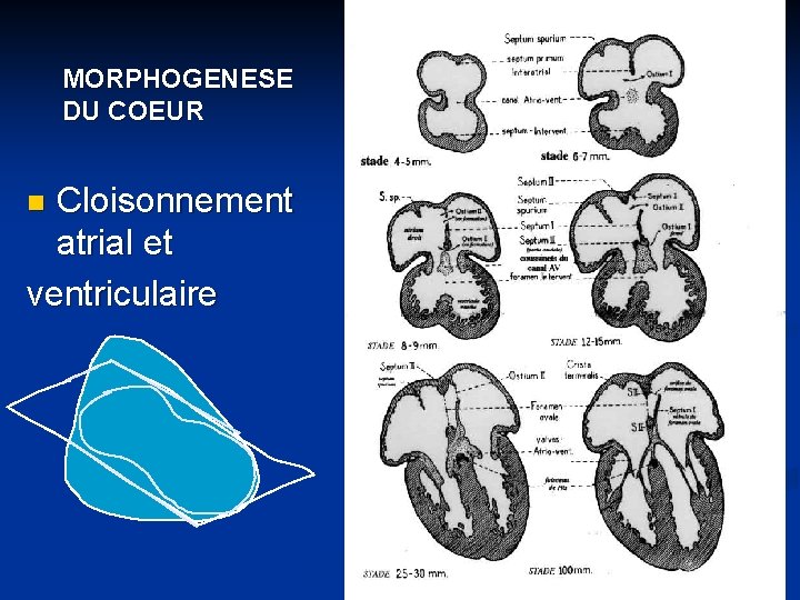 MORPHOGENESE DU COEUR Cloisonnement atrial et ventriculaire n 