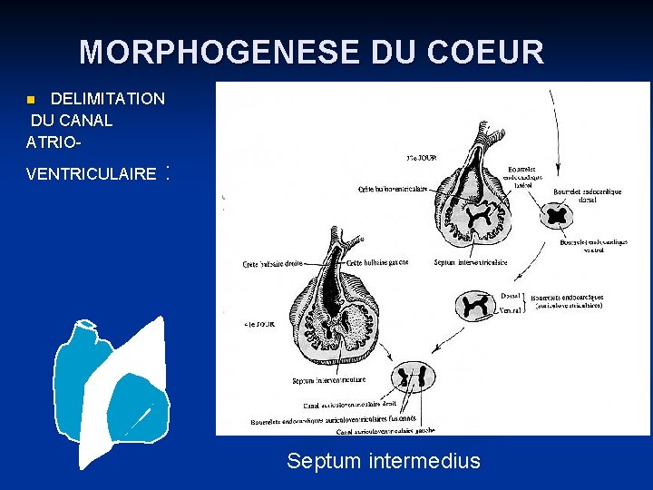 MORPHOGENESE DU COEUR DELIMITATION DU CANAL ATRIOn VENTRICULAIRE : Septum intermedius 