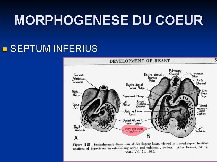 MORPHOGENESE DU COEUR n SEPTUM INFERIUS 