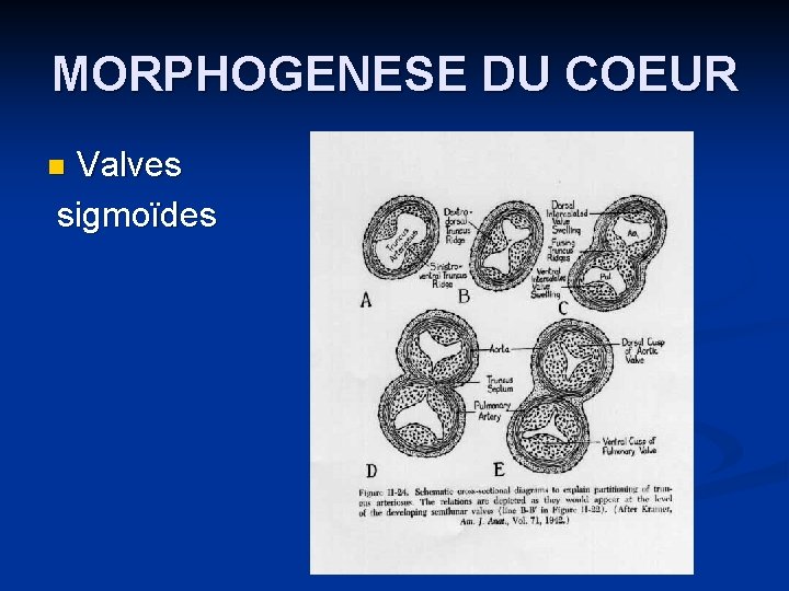 MORPHOGENESE DU COEUR Valves sigmoïdes n 