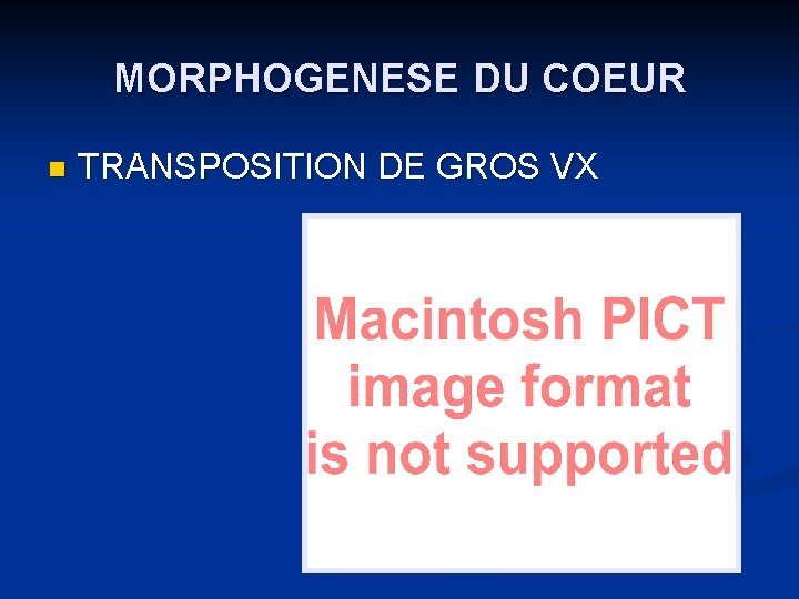 MORPHOGENESE DU COEUR n TRANSPOSITION DE GROS VX 