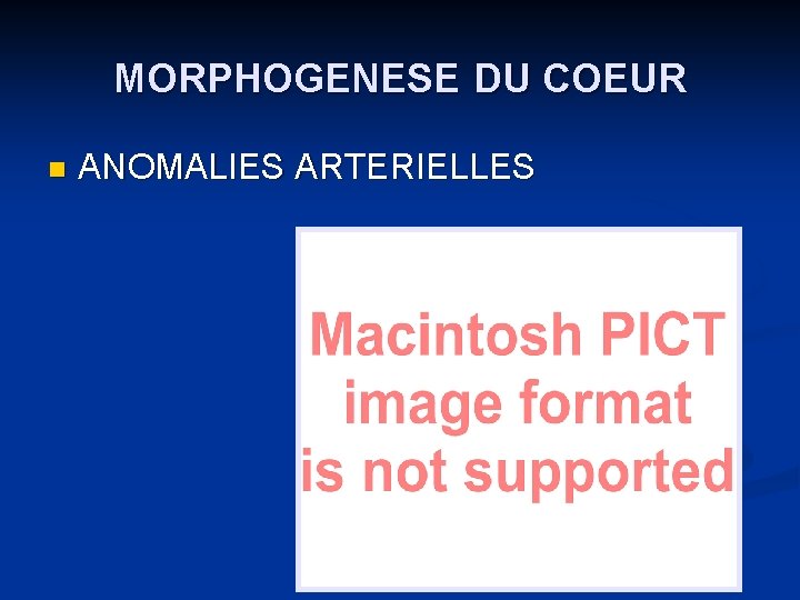 MORPHOGENESE DU COEUR n ANOMALIES ARTERIELLES 