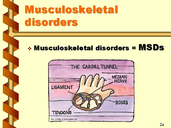 Musculoskeletal disorders v Musculoskeletal disorders = MSDs 2 a 