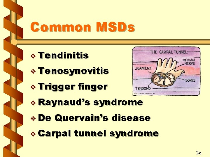 Common MSDs v Tendinitis v Tenosynovitis v Trigger finger v Raynaud’s v De syndrome