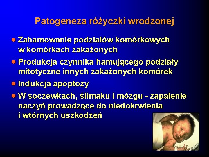 Patogeneza różyczki wrodzonej · Zahamowanie podziałów komórkowych w komórkach zakażonych · Produkcja czynnika hamującego