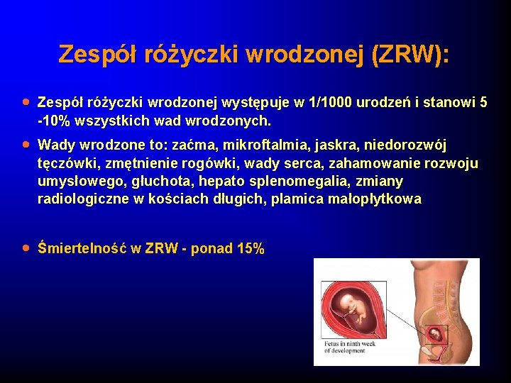 Zespół różyczki wrodzonej (ZRW): · Zespół różyczki wrodzonej występuje w 1/1000 urodzeń i stanowi