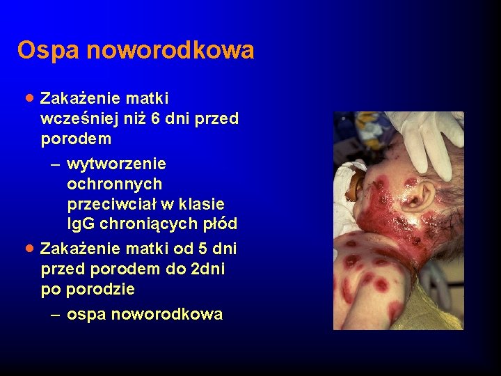 Ospa noworodkowa · Zakażenie matki · wcześniej niż 6 dni przed porodem – wytworzenie