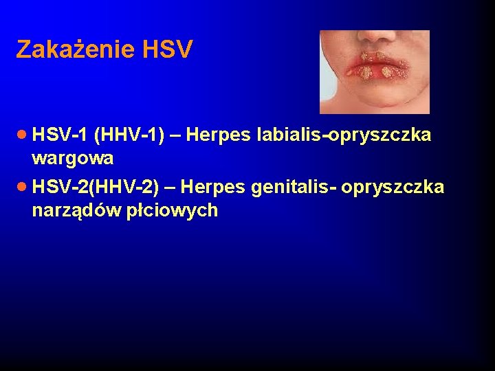 Zakażenie HSV · HSV-1 (HHV-1) – Herpes labialis-opryszczka wargowa · HSV-2(HHV-2) – Herpes genitalis-