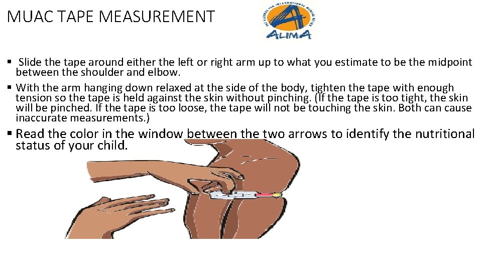 MUAC TAPE MEASUREMENT § Slide the tape around either the left or right arm MUAC TAPE MEASUREMENT § Slide the tape around either the left or right arm