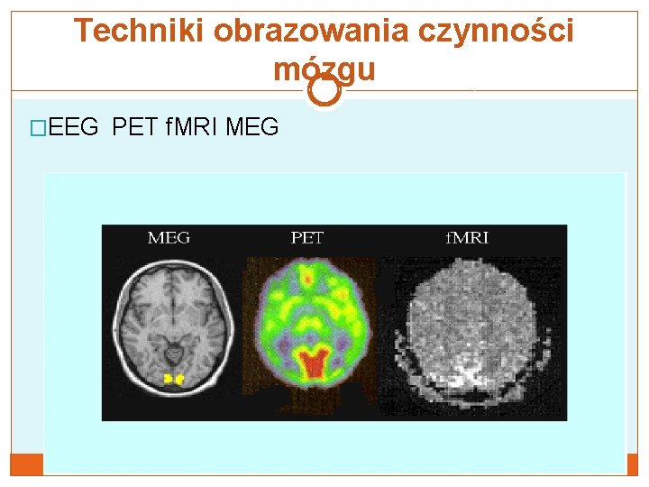 Techniki obrazowania czynności mózgu �EEG PET f. MRI MEG 