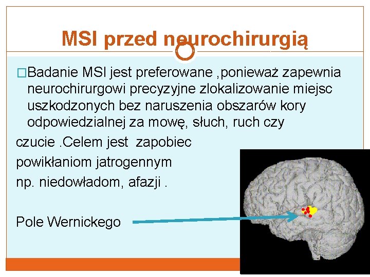 MSI przed neurochirurgią �Badanie MSI jest preferowane , ponieważ zapewnia neurochirurgowi precyzyjne zlokalizowanie miejsc