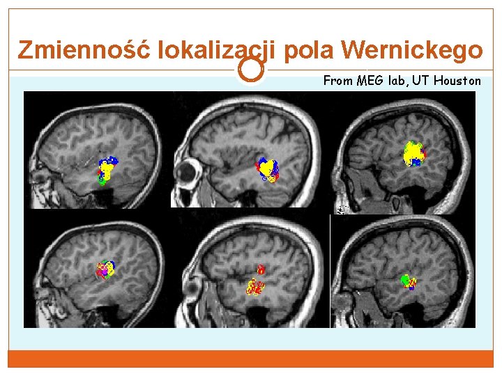 Zmienność lokalizacji pola Wernickego From MEG lab, UT Houston 