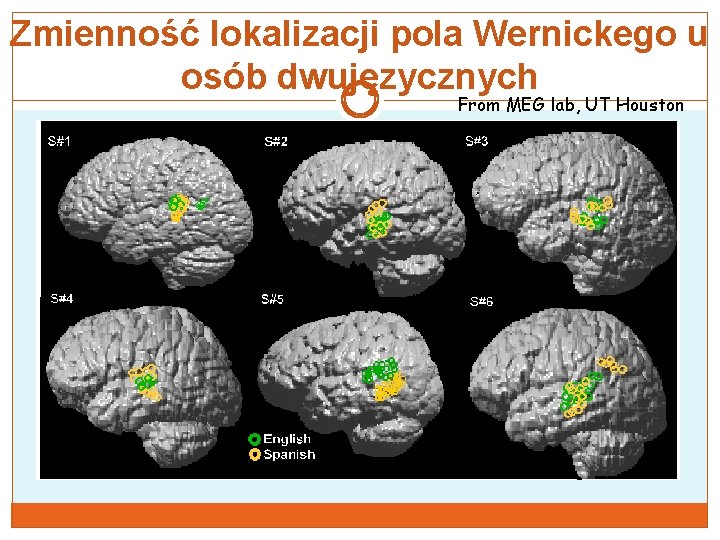 Zmienność lokalizacji pola Wernickego u osób dwujęzycznych From MEG lab, UT Houston 