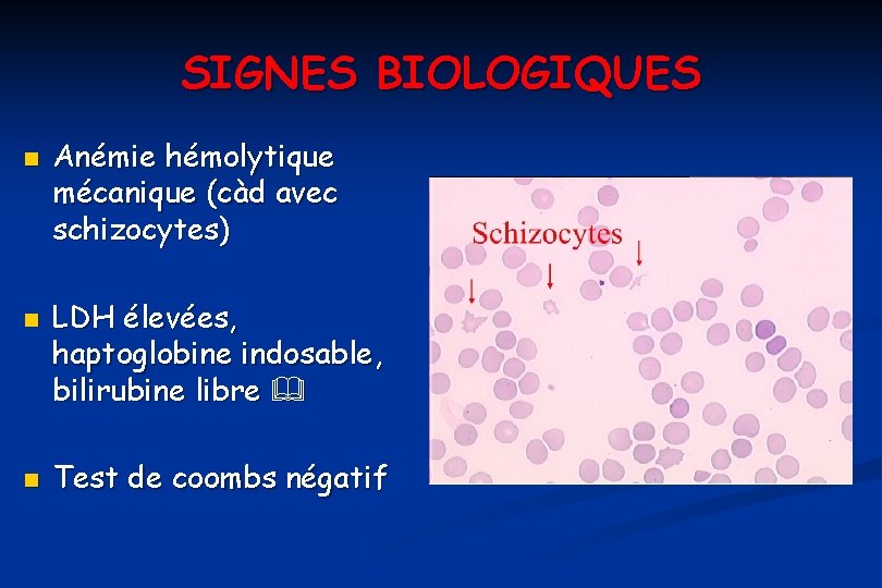 SIGNES BIOLOGIQUES n n n Anémie hémolytique mécanique (càd avec schizocytes) LDH élevées, haptoglobine