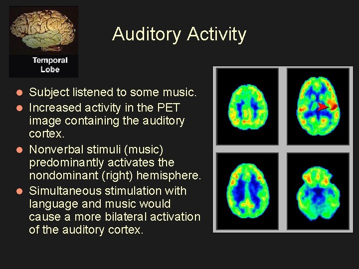 Auditory Activity Subject listened to some music. l Increased activity in the PET image