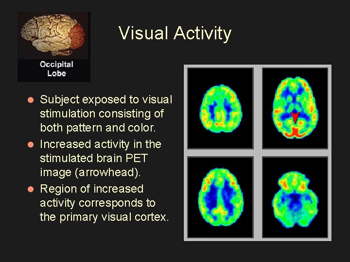 Visual Activity Subject exposed to visual stimulation consisting of both pattern and color. l