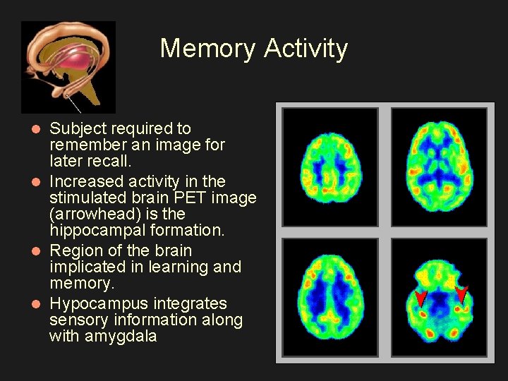 Memory Activity Subject required to remember an image for later recall. l Increased activity