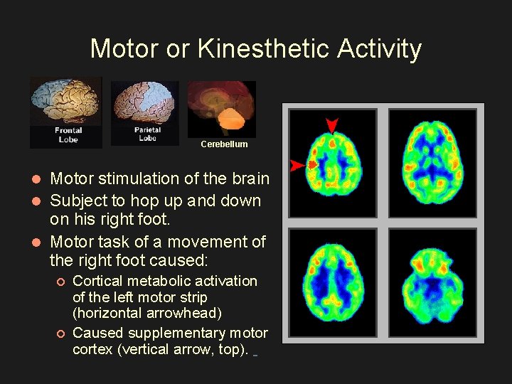 Motor or Kinesthetic Activity Cerebellum Motor stimulation of the brain l Subject to hop