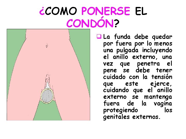 ¿COMO PONERSE EL CONDÓN? q La funda debe quedar por fuera por lo menos