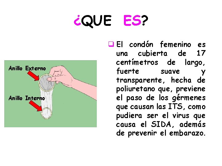 ¿QUE ES? Anillo Externo Anillo Interno q El condón femenino es una cubierta de