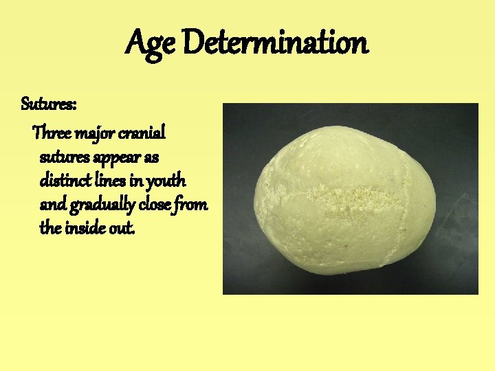 Age Determination Sutures: Three major cranial sutures appear as distinct lines in youth and