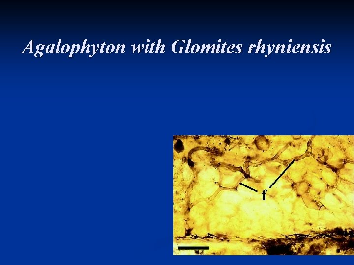 Agalophyton with Glomites rhyniensis Agalophyton with Glomites rhyniensis